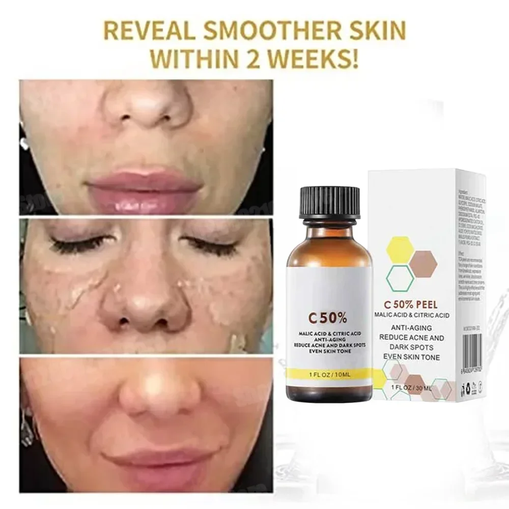 Salicylic Acid Face Facial Pee - Skincare Salicylic Acid review and price