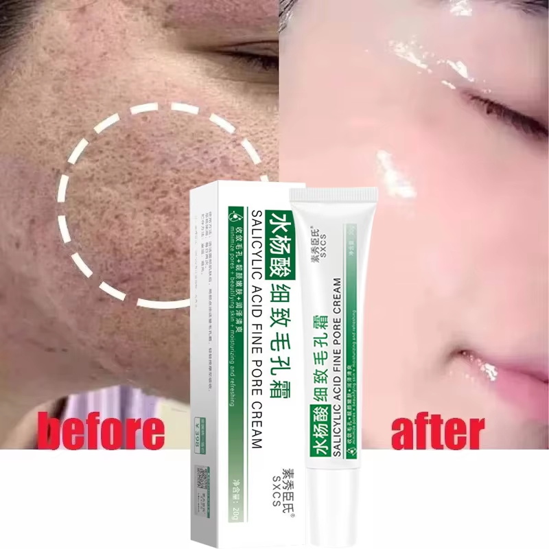 Salicylic Acid Pore Shrinking  - Skincare Salicylic Acid review and price